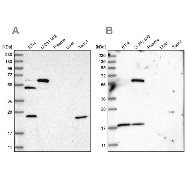 Anti-PYROXD2 antibody produced in rabbit