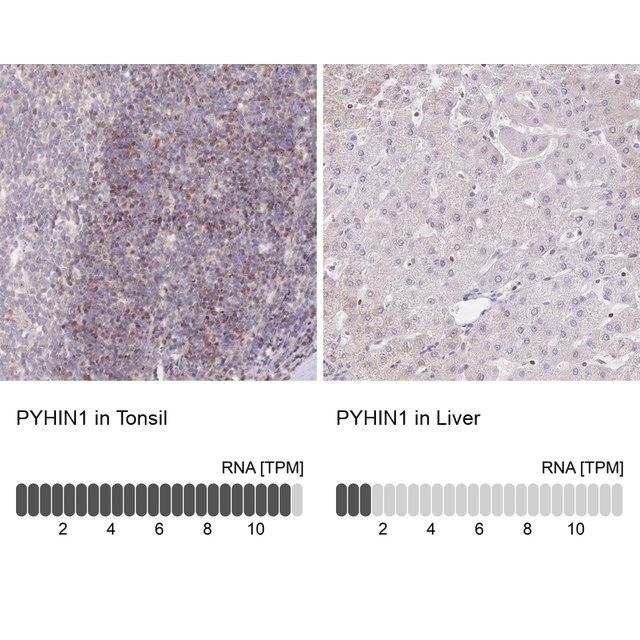 Anti-PYHIN1 antibody produced in rabbit