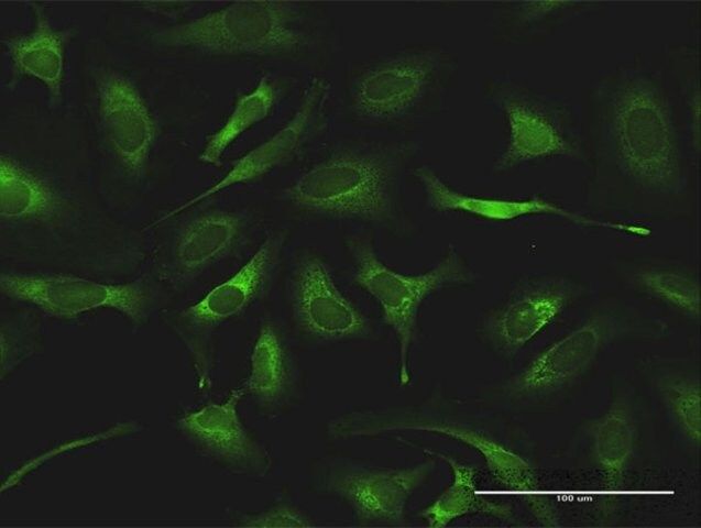 Anti-QARS antibody produced in rabbit