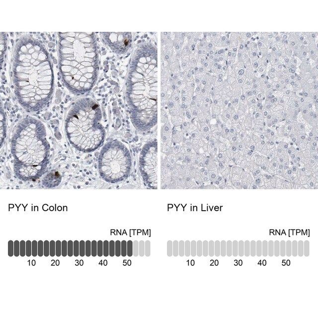 Anti-PYY antibody produced in rabbit