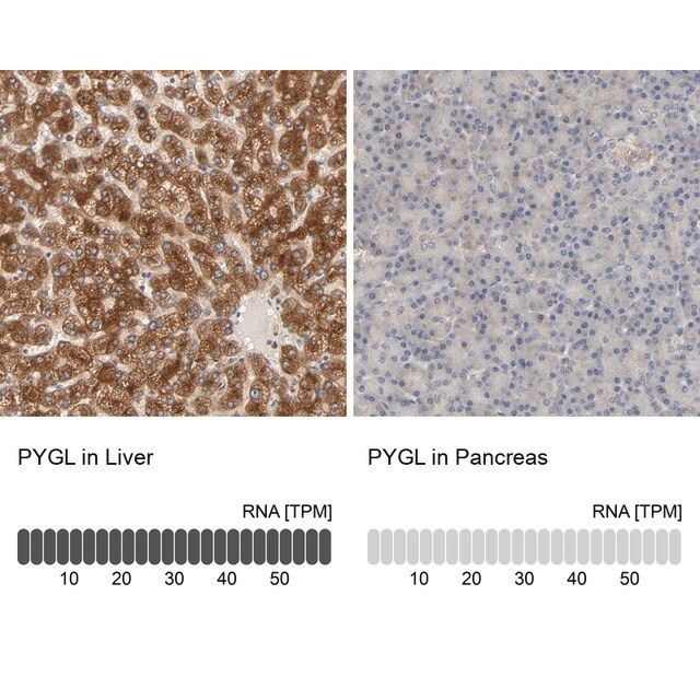 Anti-PYGL antibody produced in rabbit