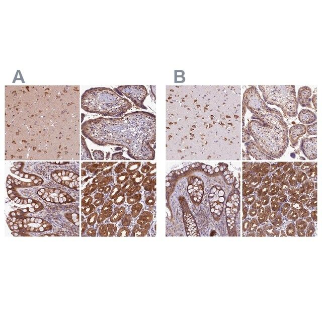 Anti-QARS antibody produced in rabbit