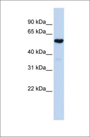 Anti-QRSL1 antibody produced in rabbit