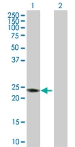 Anti-RAB7B antibody produced in rabbit