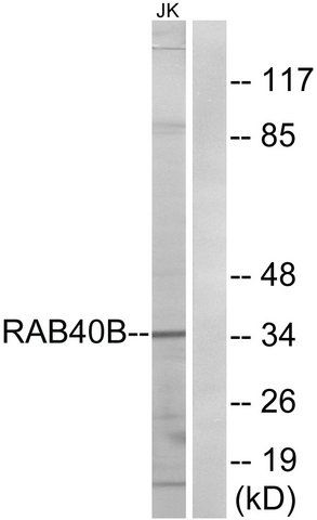 Anti-RAB40B antibody produced in rabbit