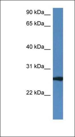 Anti-RAB27B antibody produced in rabbit