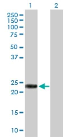 Anti-RAB39B antibody produced in rabbit