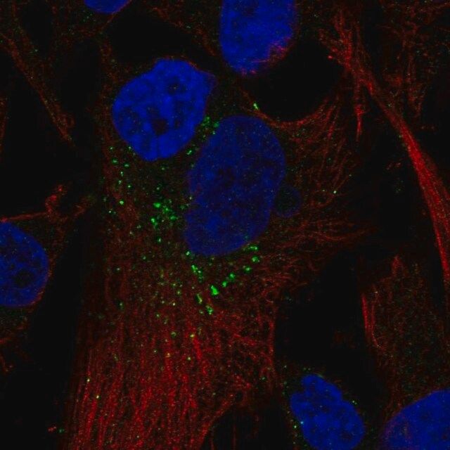 Anti-RAB5B antibody produced in rabbit