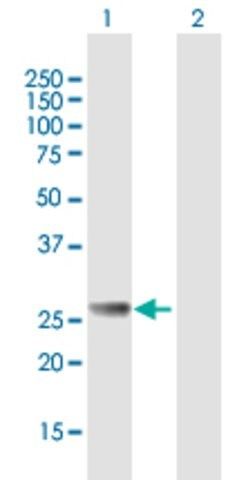 Anti-RAB27B antibody produced in mouse