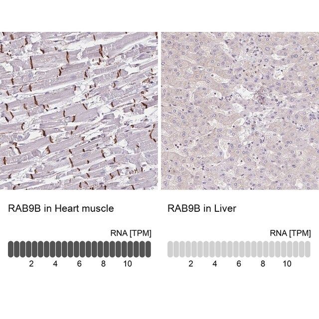 Anti-RAB9B antibody produced in rabbit