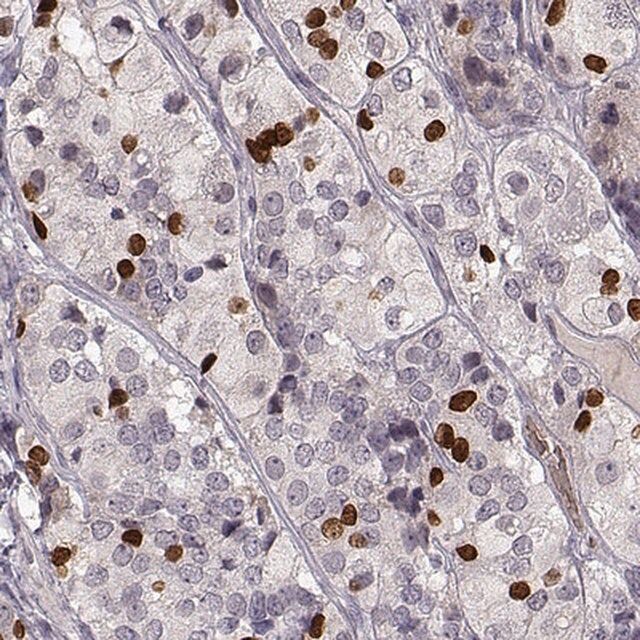 Anti-PROP1 antibody produced in rabbit