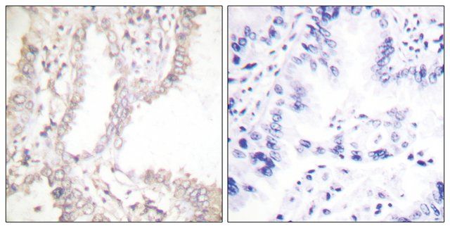 Anti-Prostate Apoptosis Response protein-4 antibody produced in rabbit