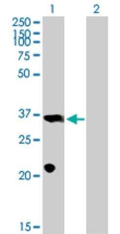 Anti-PROP1 antibody produced in mouse