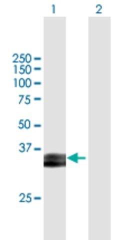 Anti-PRSS8 antibody produced in mouse