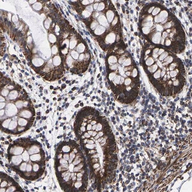 Anti-P2RY11 antibody produced in rabbit