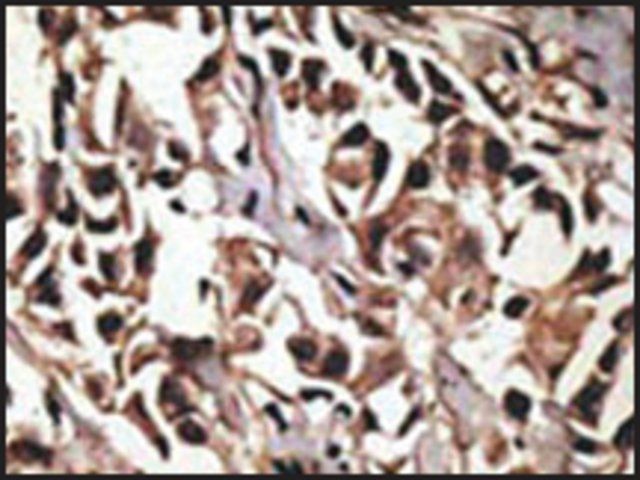 Anti-PRMT7 (C-term) antibody produced in rabbit