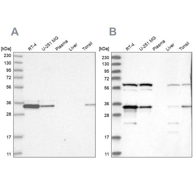 Anti-PRKRA antibody produced in rabbit