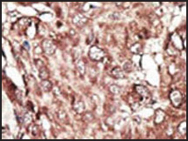 Anti-PRMT7 (N-term) antibody produced in rabbit