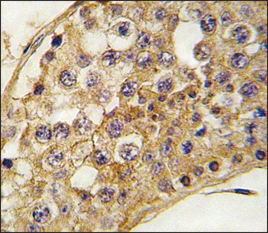 Anti-PROK1 (center) antibody produced in rabbit