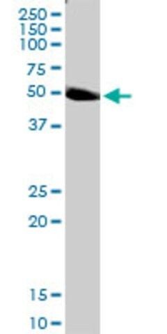 Anti-PLEKHO2 antibody produced in rabbit