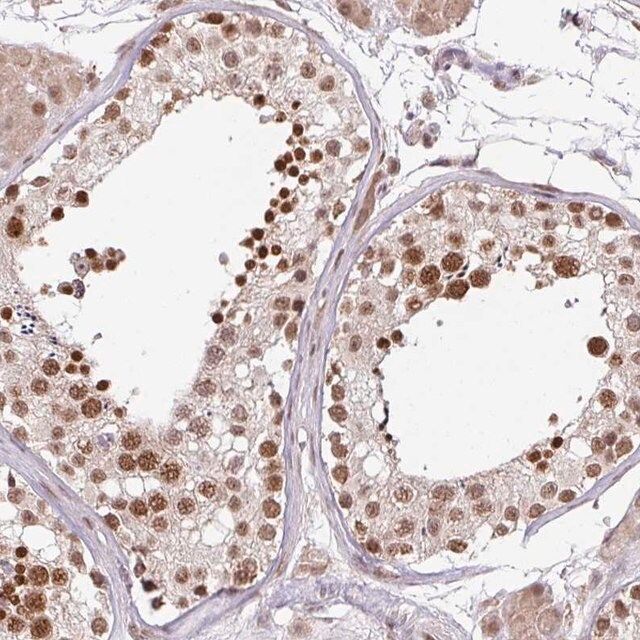 Anti-PLK1 antibody produced in rabbit