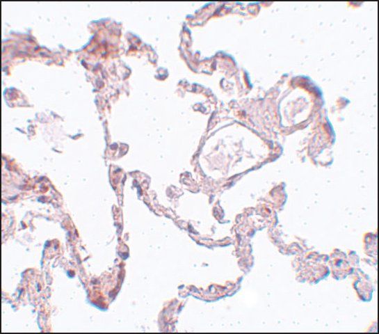 Anti-PLEKHM1 antibody produced in rabbit