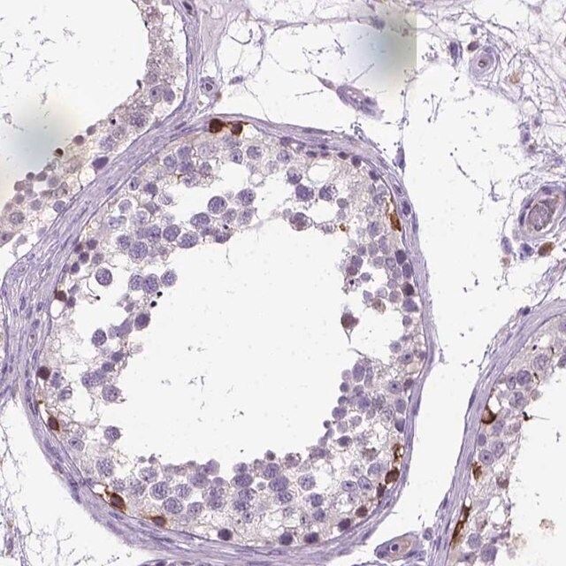 Anti-PLK4 antibody produced in rabbit