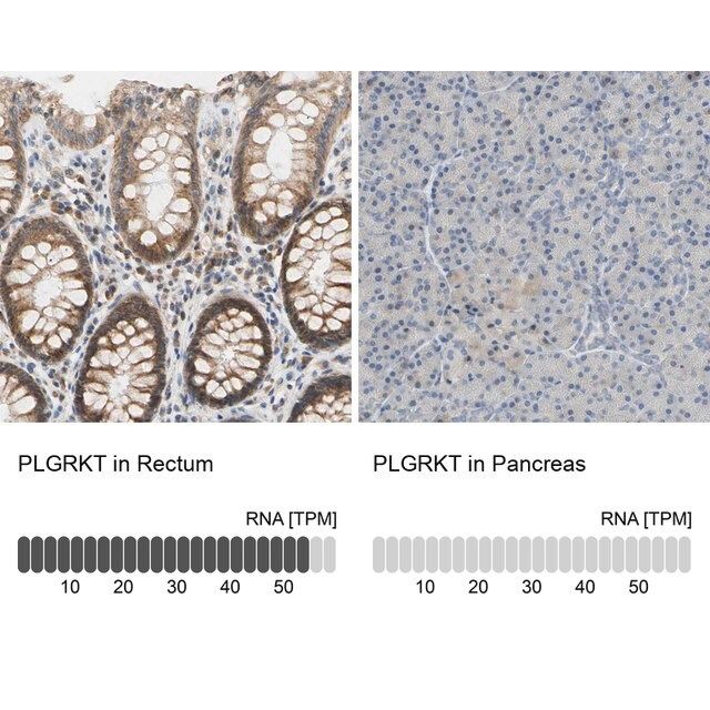 Anti-PLGRKT antibody produced in rabbit