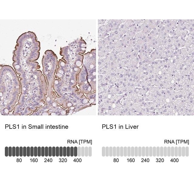 Anti-PLS1 antibody produced in rabbit