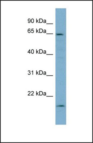 Anti-PLS3 antibody produced in rabbit