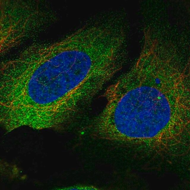 Anti-PLS3 antibody produced in rabbit