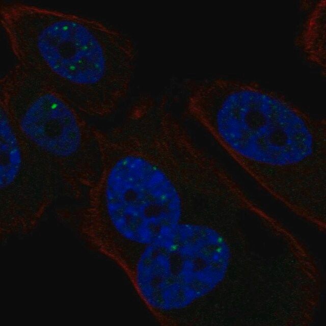 Anti-PMS1 antibody produced in rabbit