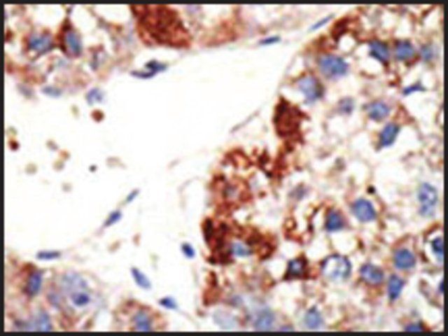 Anti-PML Sumoylation Site antibody produced in rabbit