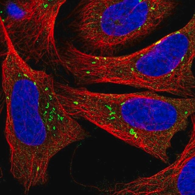 Anti-PLPP5 antibody produced in rabbit