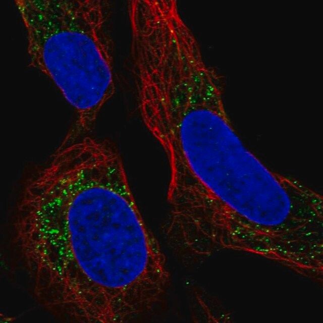 Anti-PMEPA1 antibody produced in rabbit