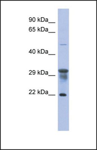 Anti-PMM1, (N-terminal) antibody produced in rabbit