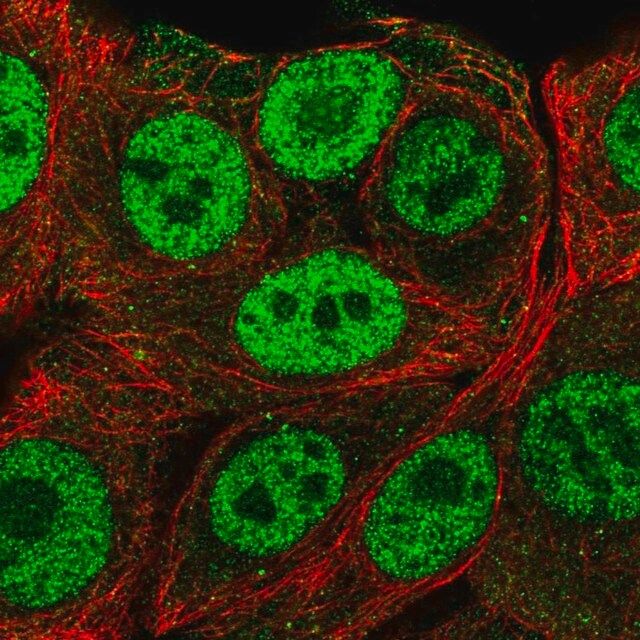 Anti-PMF1 antibody produced in rabbit