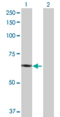 Anti-PLTP antibody produced in rabbit