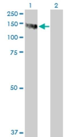 Anti-PMFBP1 antibody produced in mouse