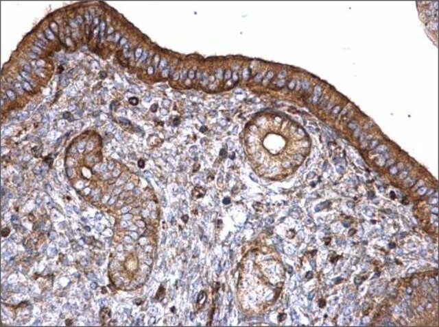 Anti-PLS3 antibody produced in rabbit