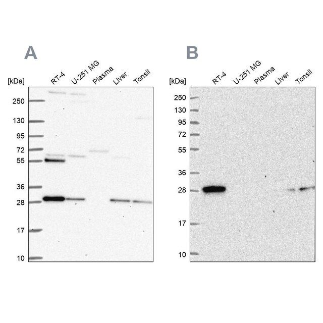 Anti-PMM2 antibody produced in rabbit