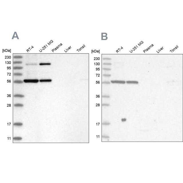 Anti-PLRG1 antibody produced in rabbit