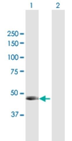 Anti-PNLIP antibody produced in mouse