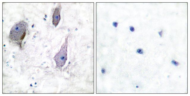 Anti-PMP22 antibody produced in rabbit