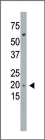 Anti-PMVK (C-term L177) antibody produced in rabbit