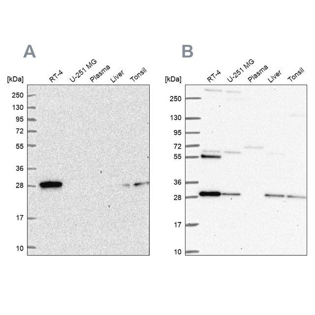 Anti-PMM2 antibody produced in rabbit