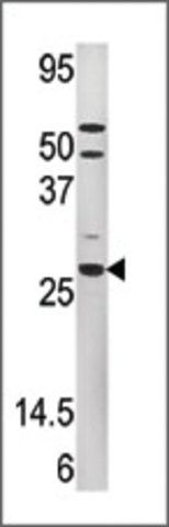 Anti-PMVK (C-term) antibody produced in rabbit