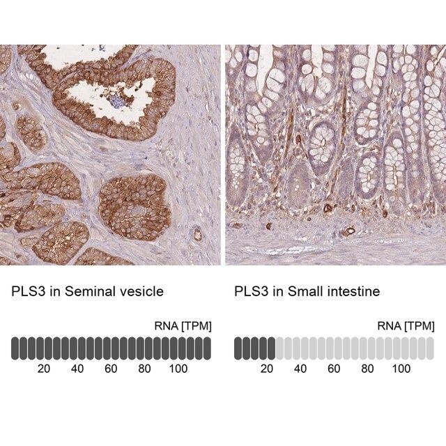 Anti-PLS3 antibody produced in rabbit