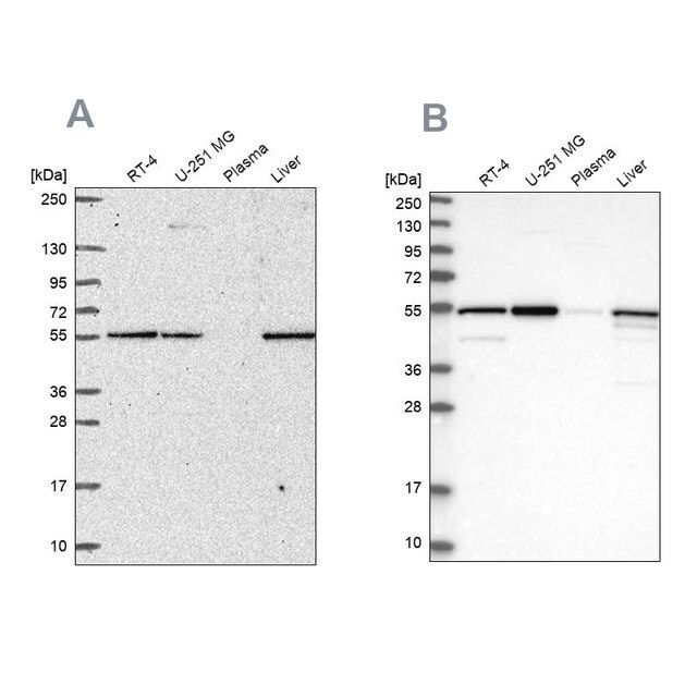 Anti-PMPCA antibody produced in rabbit