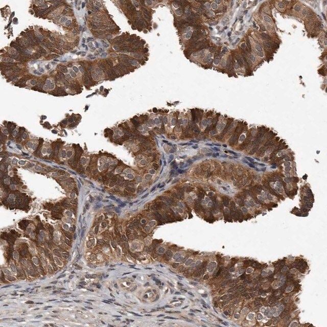 Anti-PMVK antibody produced in rabbit